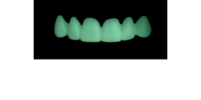 Cod.C7Facing : 10x  wax facings-bridges,  SMALL, Square ovoid, TOOTH 13-23, compatible with Cod.A7Lingual,TOOTH 13-23 for long-term provisionals preparation